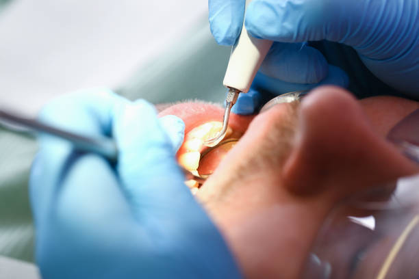 Best Emergency Root Canal Treatment in Woodville, MS