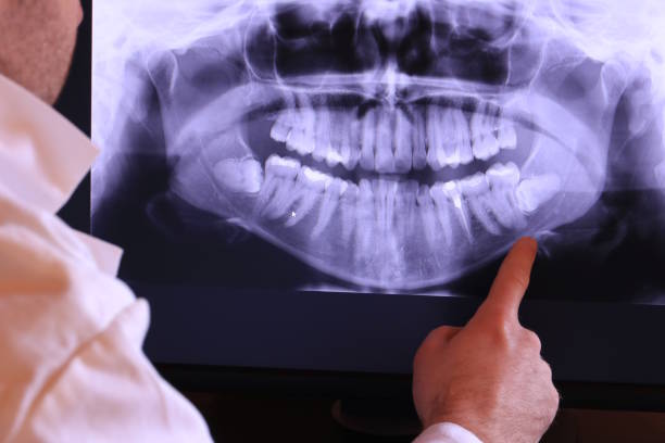 Best After-Hours Emergency Dentist in Woodville, MS